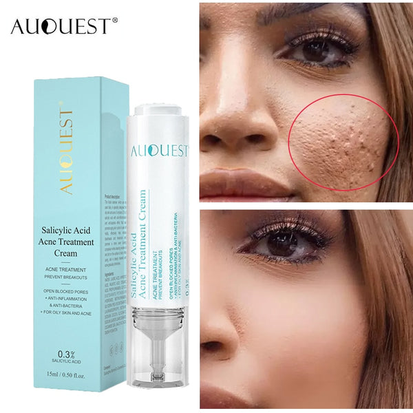 AUQUEST Salicylic Acid Acne Face Cream Whitening Facial Treatment Hyaluronic Acid Black Dots Remove Skin Care Beauty Health