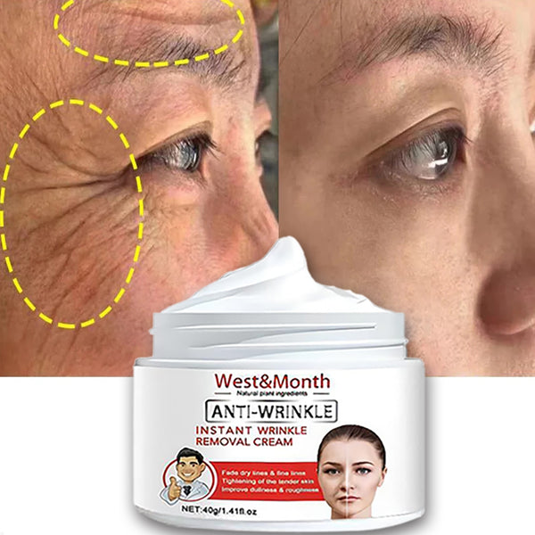 Remove Wrinkle Anti-Aging Fade Fine Lines Face Whitening Brighten Skin Beauty Health Care Retinol Lifting Firming Cream