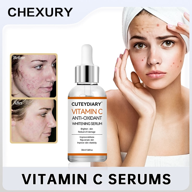 Vitamin C Face Serum Whitening Anti Dark Spot Hyaluronic Acid Facial Essence Skin Care Beauty Health