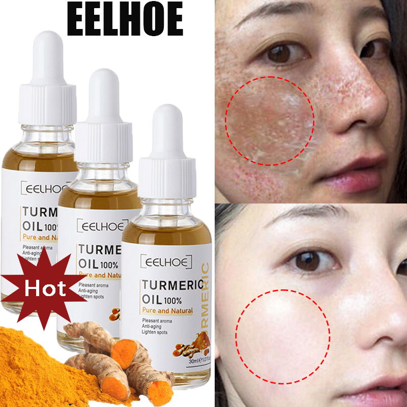 10PCS Whitening Freckle Serum Brighten