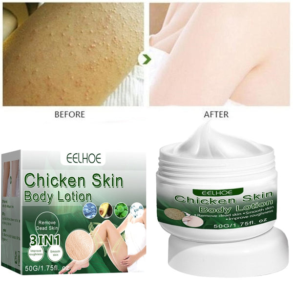 Skin Repairing Cream Body Moisturizing Whiten Serum Skin Softening Cream Chicken Skin Remove Treatment Winter Relieve Dry Skin